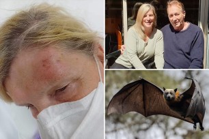 Australian grandma Sandi Galloway, 67, feared she contracted a fatal virus after getting bitten on the head by a bat while on vacation in Cairns.