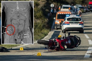 A composite of a motorcycle accident and photos from a CT scan showing the patient's testicle in his abdomen.